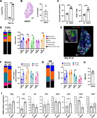 Infection with hypervirulent Mycobacterium tuberculosis triggers emergency myelopoiesis but not trained immunity